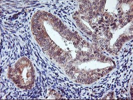 AGPAT5 Antibody (clone OTI1D12)