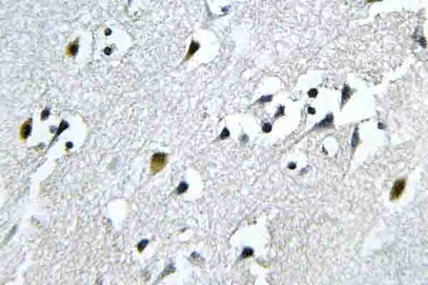 Polyclonal Rabbit anti-Human N4BP1 Antibody (Tyr415, IHC, WB)