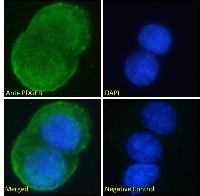 IHC-plus™ PDGF-BB Antibody (aa222-233)