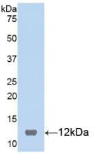 Rat S100B / S100 Beta Protein (Native His, N-Terminal)