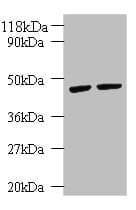 KRT18 / CK18 / Cytokeratin 18 Antibody