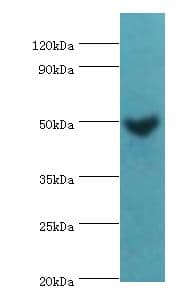 IHC-plus™ MAP2K5 / MEK5 Antibody (aa1-190)