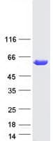 Human IRF5 Protein (Recombinant Myc-DDK (Flag))