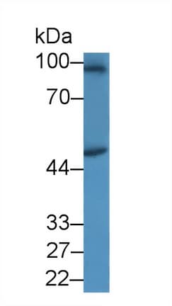 SPAG1 / TPIS Antibody (aa1-365, APC)