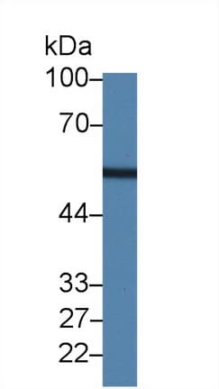Leucine Aminopeptidase Antibody (aa206-496)