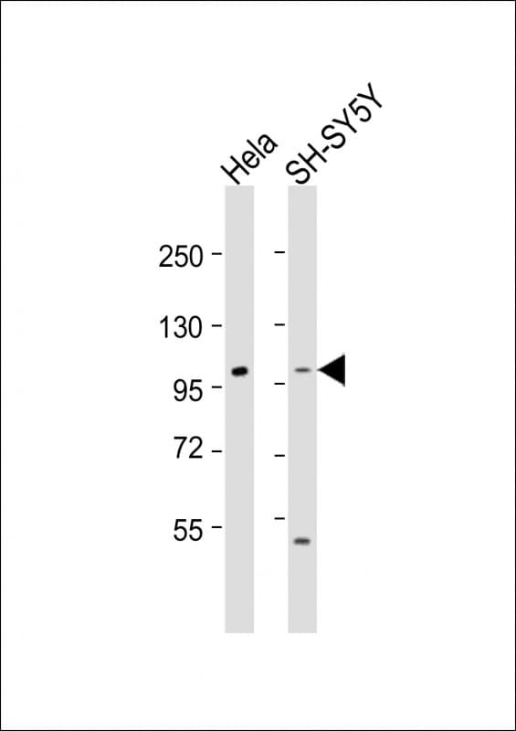 Polyclonal Rabbit anti-Human ADCY5 / Adenylate Cyclase 5 Antibody (aa604-639, WB)