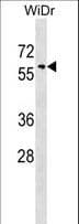 SNX18 Antibody (aa485-514)