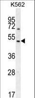 Polyclonal Rabbit anti-Human RGS7 Antibody (aa440-469, IHC, WB)