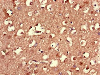 LMBRD1 Antibody