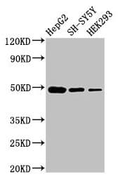 IHC-plus™ FDFT1 / Squalene Synthase Antibody