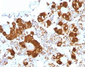 ACTH Antibody (clone CLIP/1407)