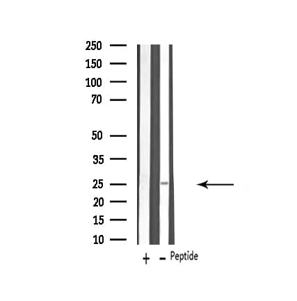 VTI1B Antibody