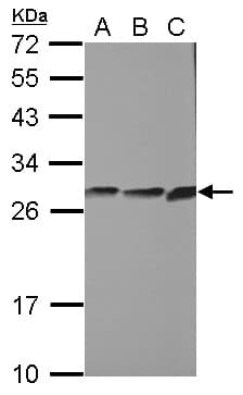Polyclonal Rabbit anti-Human CYB5R2 Antibody (WB)
