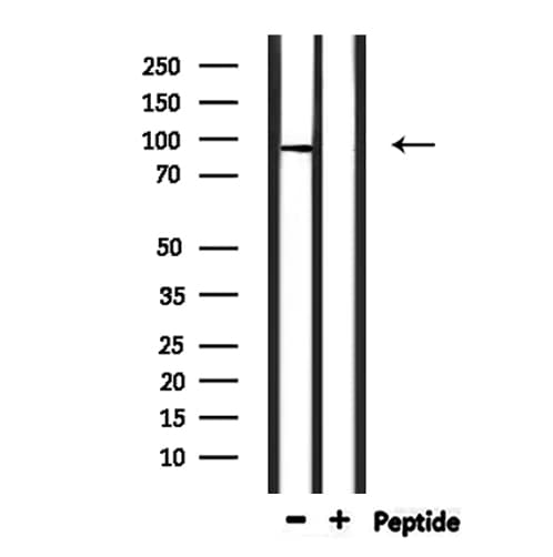 TRPV4 Antibody (aa847-867)