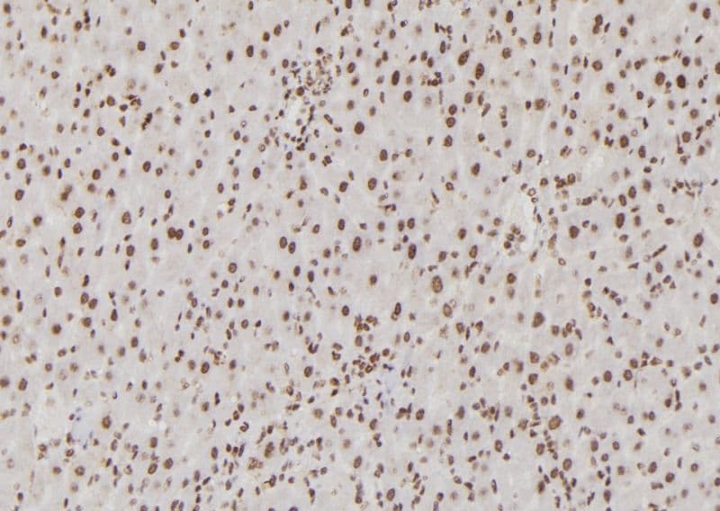 Polyclonal Rabbit anti-Human USF1 / USF Antibody (IHC, WB)