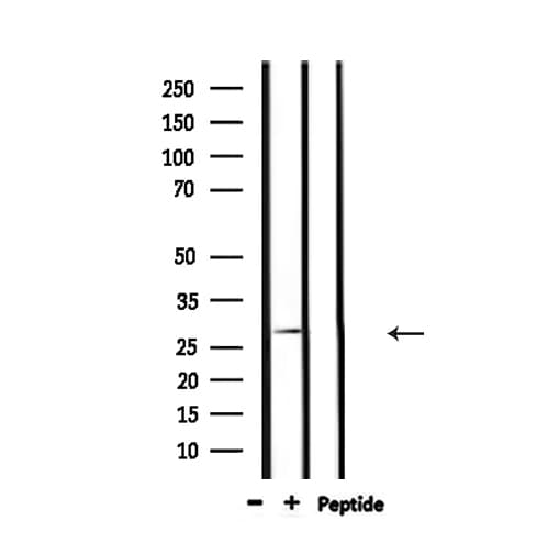 Polyclonal Rabbit anti-Human LGALS3 / Galectin 3 Antibody (IHC, IF, WB)