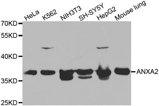 ANXA2 / Annexin A2 Antibody