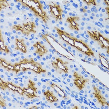 Polyclonal Rabbit anti-Human MME / CD10 Antibody (IHC, WB)