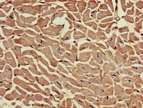 Polyclonal Rabbit anti-Human RAI1 Antibody (IHC, IF, WB)