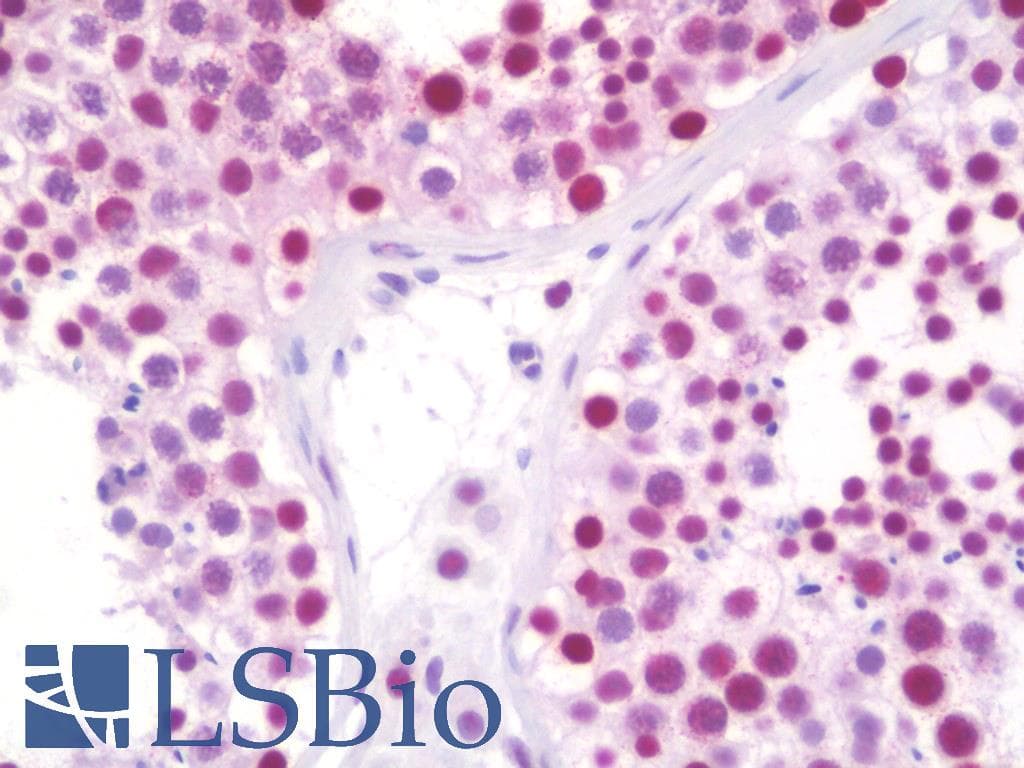 IHC-plus™ SAE2 / UBA2 Antibody (clone 4A3)