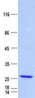 Human C3orf84 Protein (Recombinant His, N-Terminal)