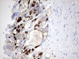 Monoclonal Mouse anti-Human MKI67 / Ki67 Antibody (clone OTI5E4, aa1160-1493, IHC)