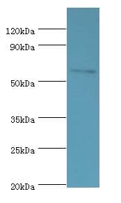 DHCR24 / Seladin-1 Antibody (aa227-516)