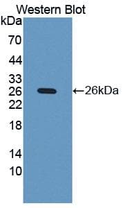 IVL / Involucrin Antibody (aa36-152)