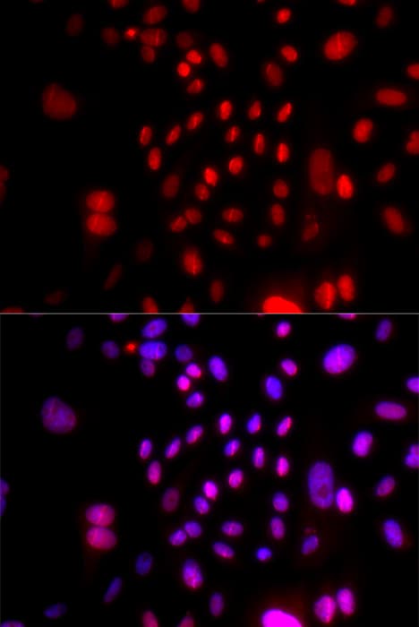 Polyclonal Rabbit anti-Human RFC4 Antibody (IHC, IF, WB)