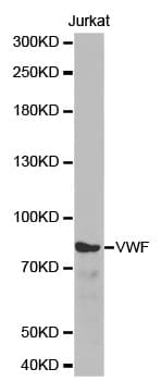 IHC-plus™ VWF / Von Willebrand Factor Antibody