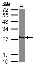 Polyclonal Rabbit anti-Human AGPAT1 Antibody (WB)