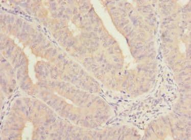 Polyclonal Rabbit anti-Human NELFB / COBRA1 Antibody (IHC, WB)