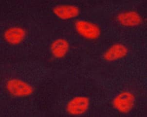 Polyclonal Rabbit anti-Human ESR2 / ER Beta Antibody (phospho-Ser105, IF, WB)