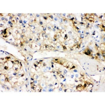 AHSG / Fetuin A Antibody (aa33-65)