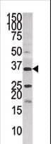 PANK3 Antibody (aa150-181)