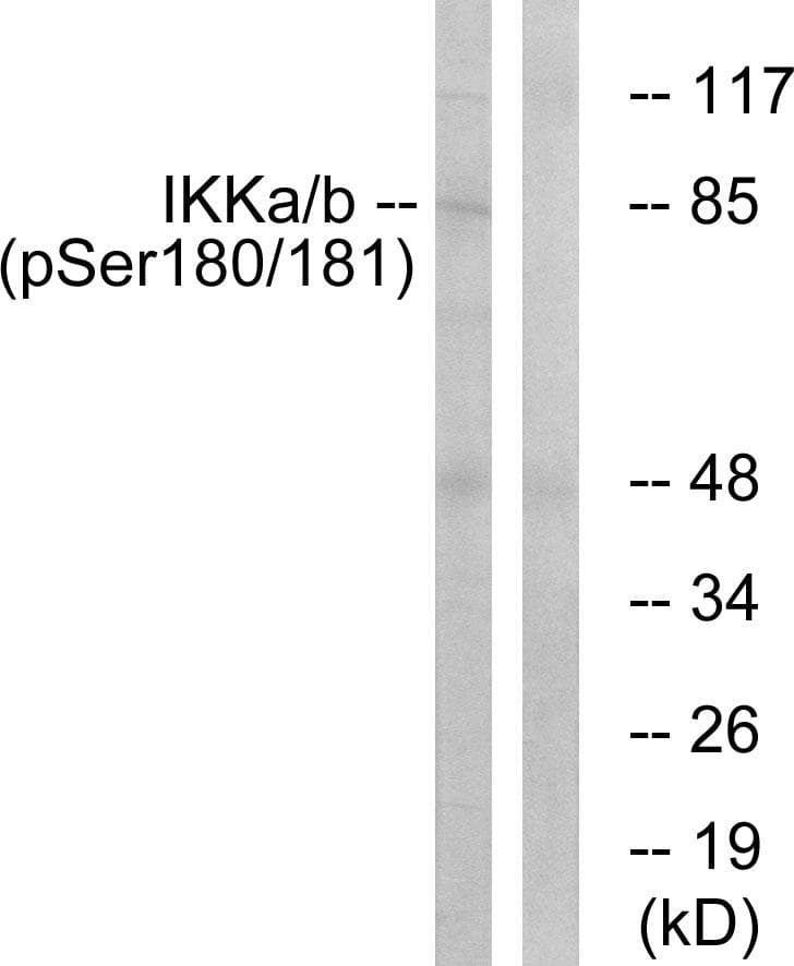 CHUK / IKKA / IKK Alpha Antibody (phospho-Ser180/181)