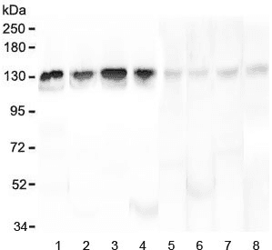 LARS / Leucyl-TRNA Synthetase Antibody