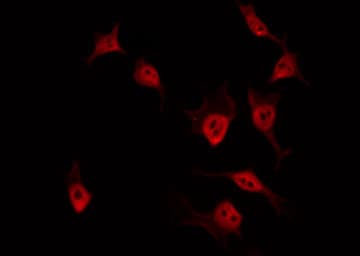 ZC3H7B Antibody