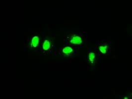 Monoclonal Mouse anti-Human MAP2K4 / MKK4 Antibody (clone OTI2D5, IHC, IF, WB)