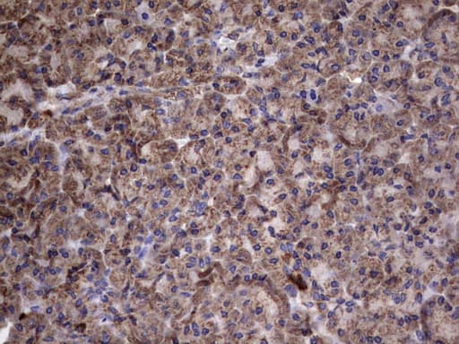 IL1RN Antibody (clone OTI2B1)
