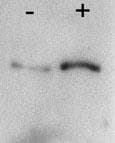 Polyclonal Rabbit anti-Human BECN1 / Beclin-1 Antibody (WB)