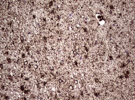 Vimentin Antibody (clone OTI5C10)