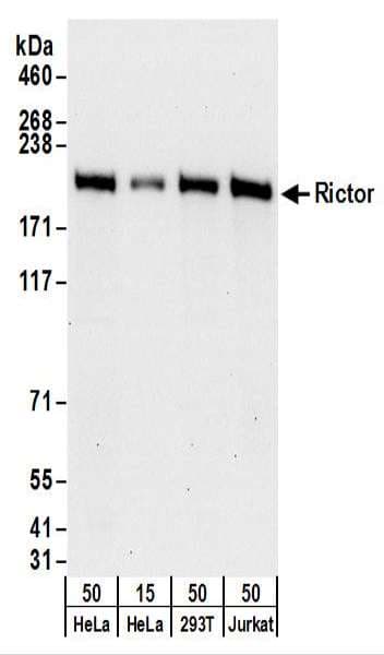 IHC-plus™ RICTOR Antibody (aa1650-C-term)