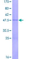 Human IFNW1 Protein (Recombinant GST)