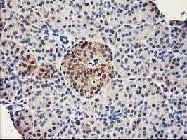 Monoclonal Mouse anti-Human RBBP7 / RbAp46 Antibody (clone OTI5A4, IHC, WB)
