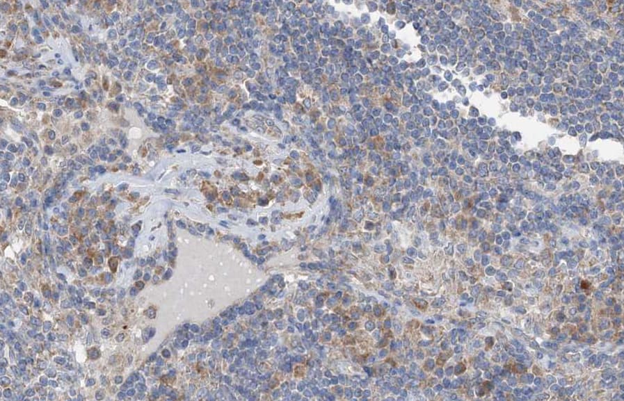 p66 / SHC Antibody (phospho-Tyr349)