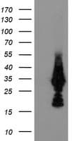 MMACHC Antibody (clone OTI6H5, Carrier-free)