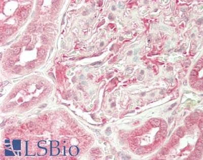 IHC-plus™ OSBPL2 Antibody (aa418-480)