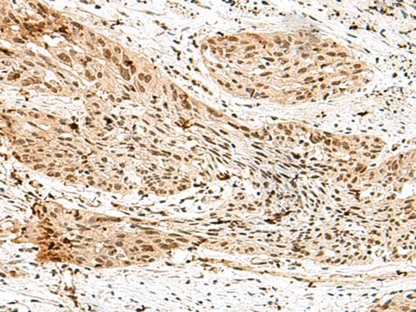 Polyclonal Rabbit anti-Human RBM15 Antibody (IHC)