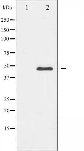 CAMK2A / CaMKII Alpha Antibody